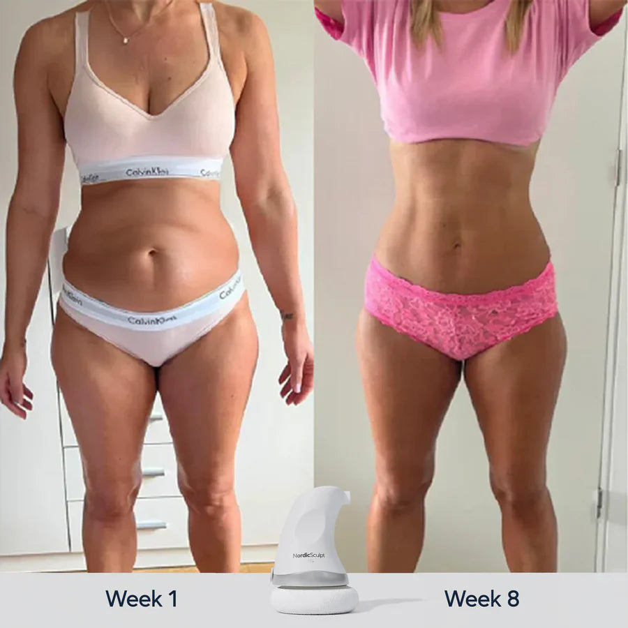 SculptFlex™ 2.0 – Ultra Sonic Body Toning & Fat-Reducing Device