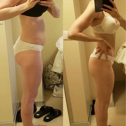 SculptFlex™ 2.0 – Ultra Sonic Body Toning & Fat-Reducing Device